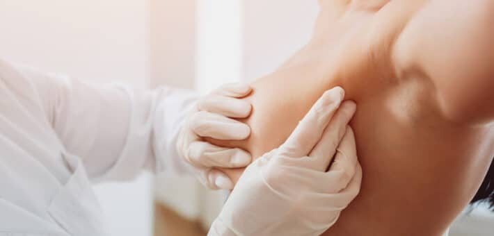 Augmentation du nombre de cancer du sein