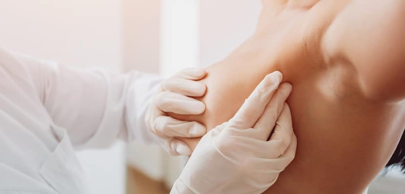 Augmentation du nombre de cancer du sein